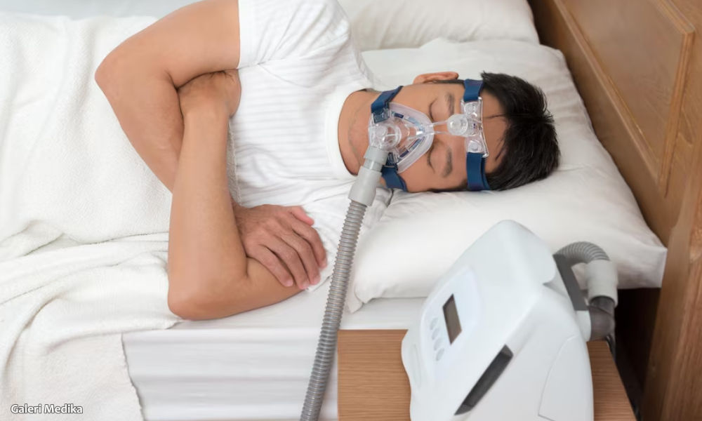 Cara Menggunakan Mesin CPAP untuk Sleep Apnea