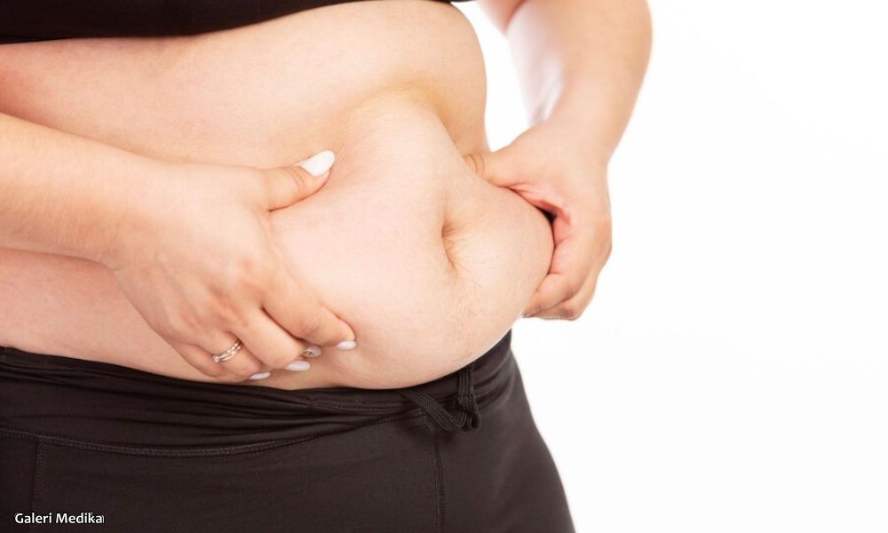 7 Cara Menurunkan Body Fat Secara Sehat