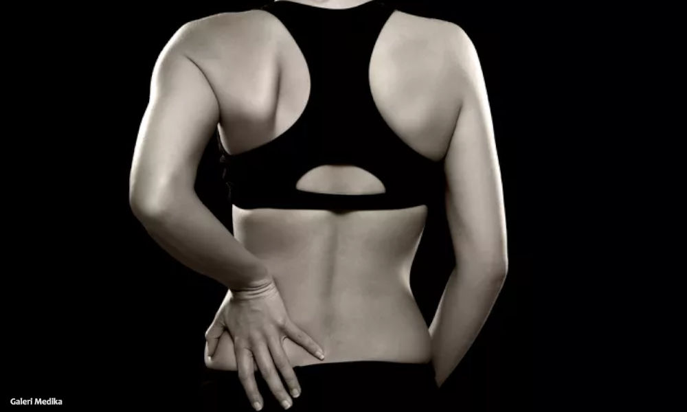 Lordosis: Penyebab, Gejala dan Cara Mengobati