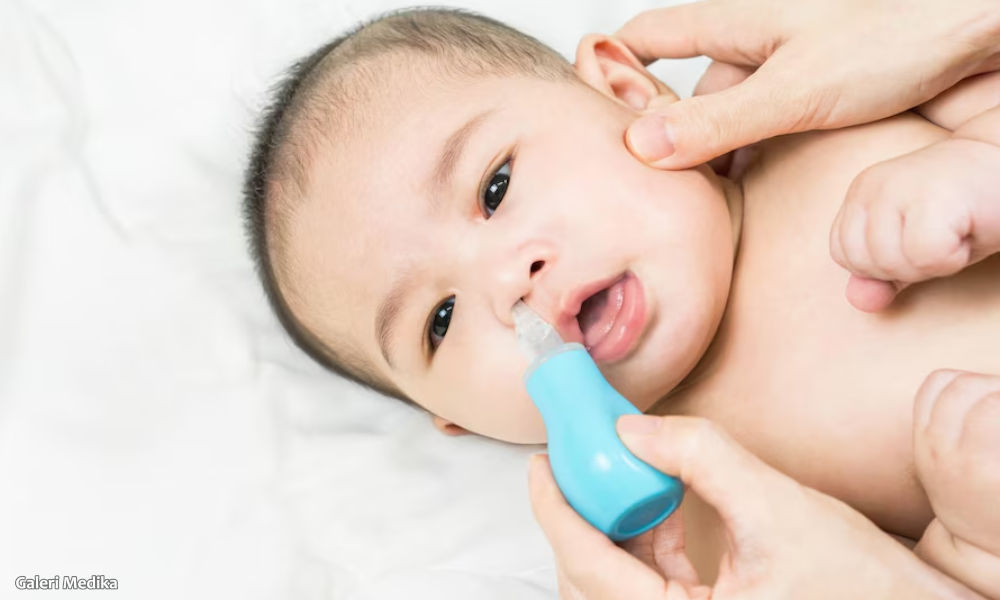 Amankah Menggunakan Nasal Aspirator untuk Bayi?