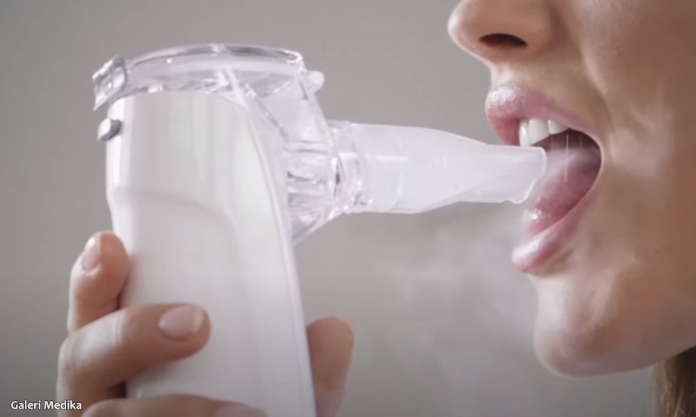 Apa itu Nebulizer Mesh? Bagaimana Cara Kerjanya?