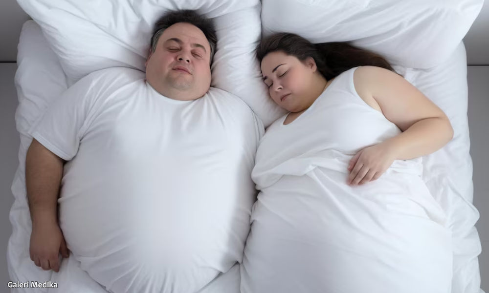 Perbedaan Obstruktif Sleep Apnea dan Central Sleep Apnea