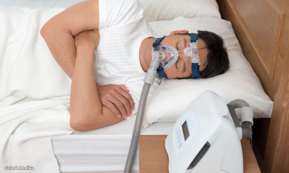 Perbedaan Obstruktif Sleep Apnea dan Central Sleep Apnea