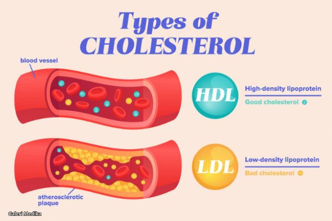 apa itu obat statin