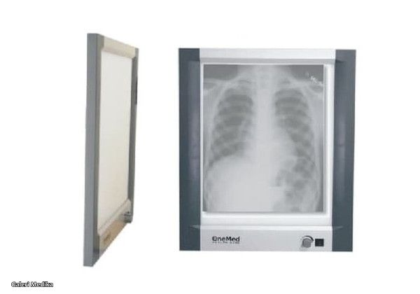 kegunaan x-ray film