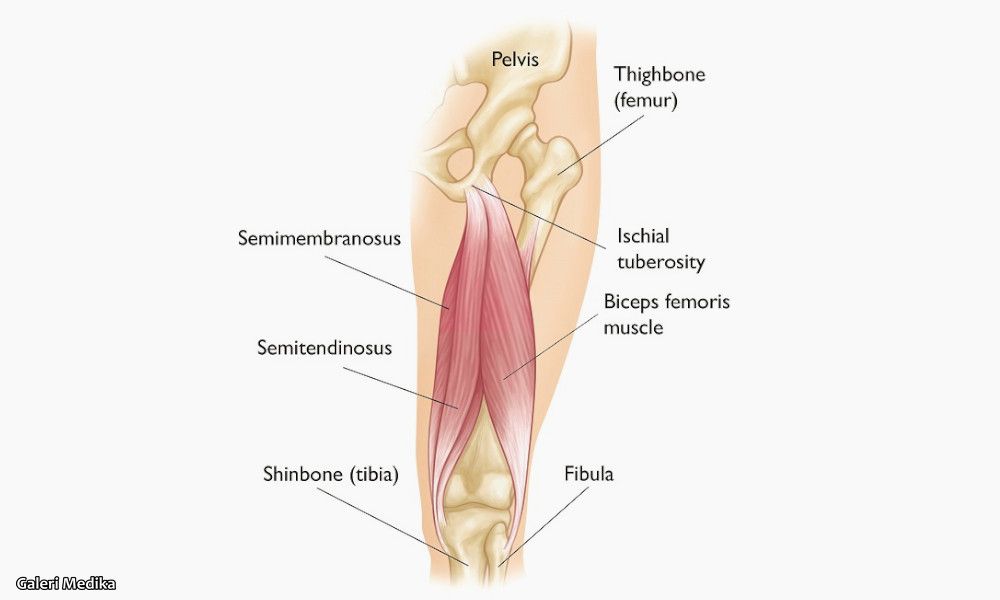 penyebab cedera hamstring