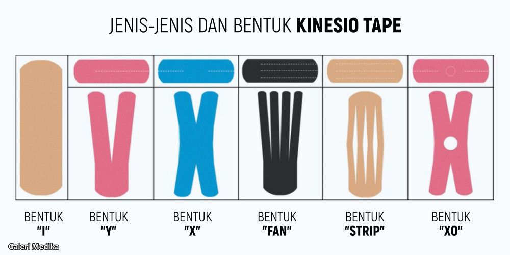 manfaat menggunakan kinesio tape