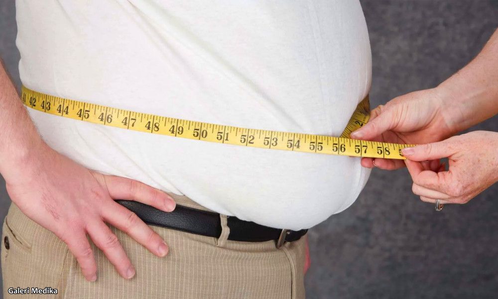 penyebab obesitas dan bagaimana cara mencegah