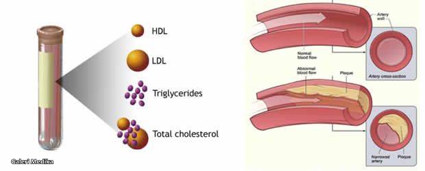 Apa itu Profil Lipid? Bagaimana Cara Mengukurnya?