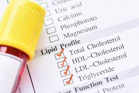 Tes Kolestrol Lipid Profil