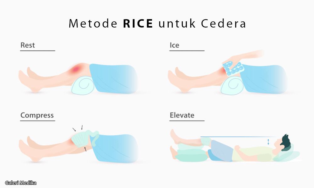 mengenal tindakan rice saat cedera