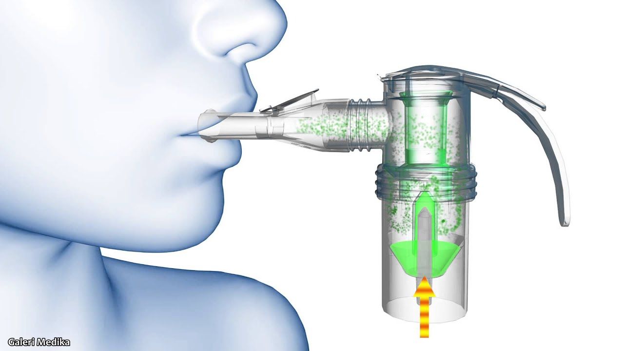 Cara kerja nebulizer