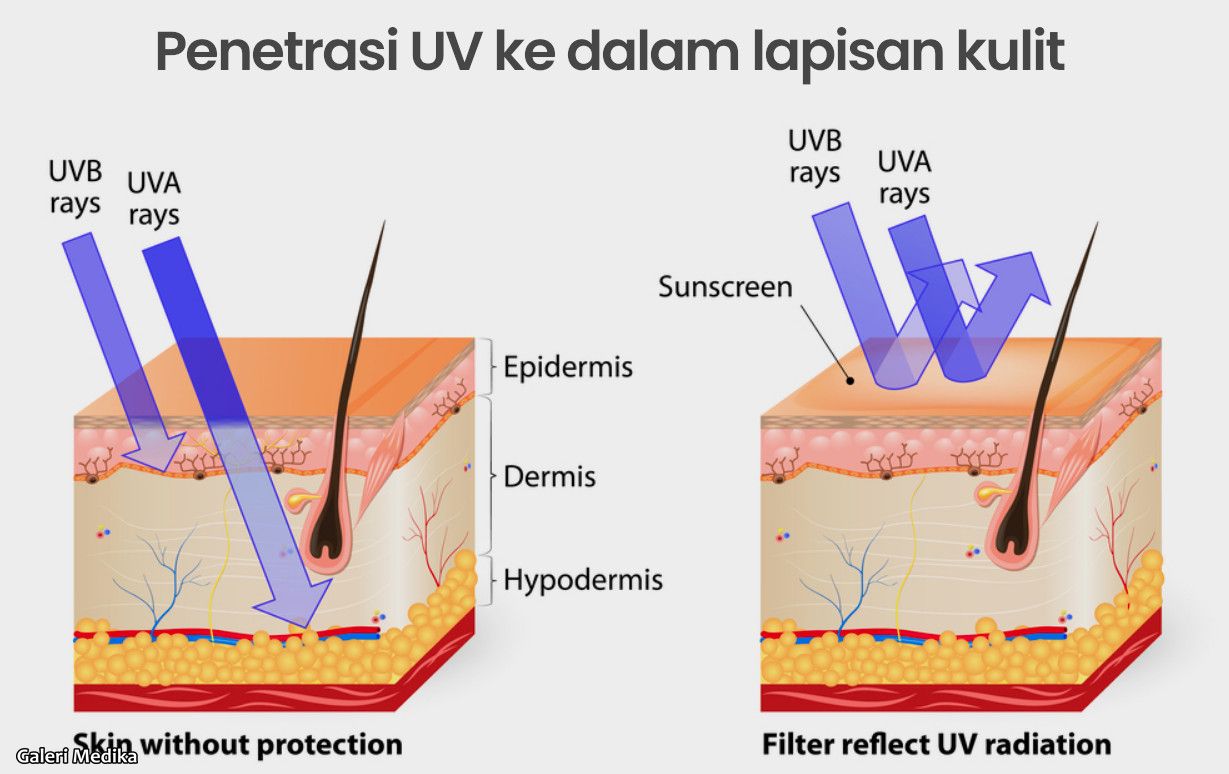 Tips Melindungi Diri Dari Radiasi UV