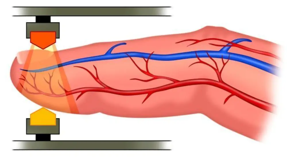Temuan Penting Studi Terbaru: Oximeter Jari Tak Selalu Akurat Pada Kulit Gelap
