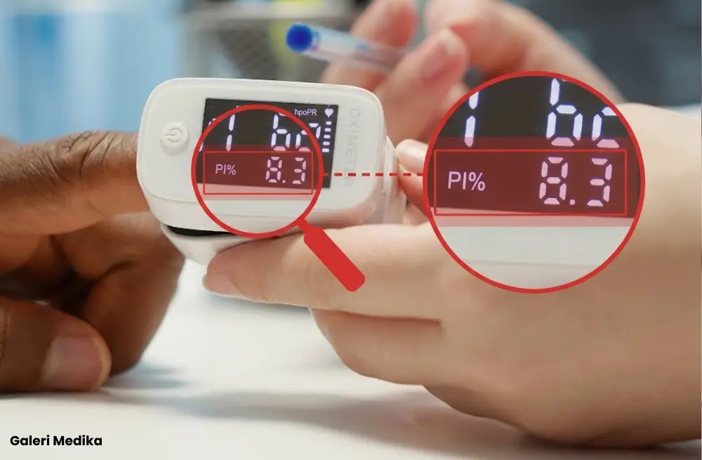 Perfusion Index