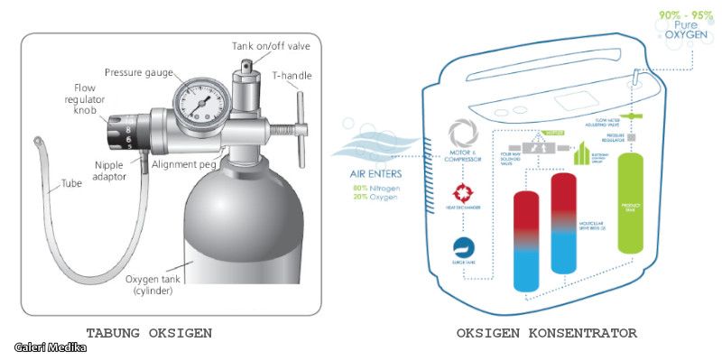 Tabung Oksigen VS Oksigen Konsentrator