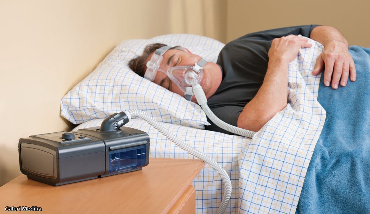 Terapi CPAP untuk Gangguan Sleep apnea